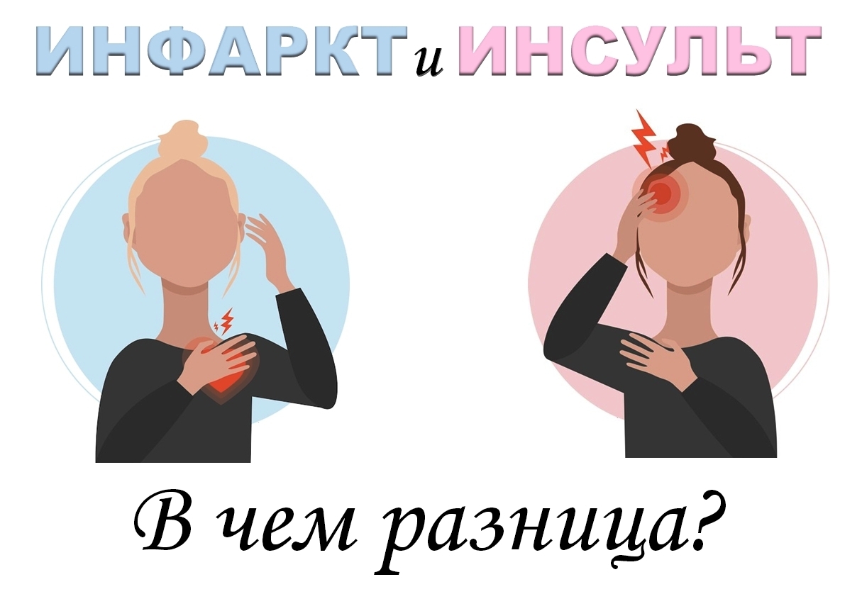 Как распознать инфаркт и инсульт: инструкции, которые спасают жизни